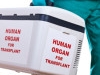 Organ-Transplant-Case-100x100